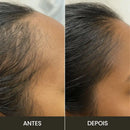 Escova de Terapia Capilar: TheraBrush Smarts 4 em 1